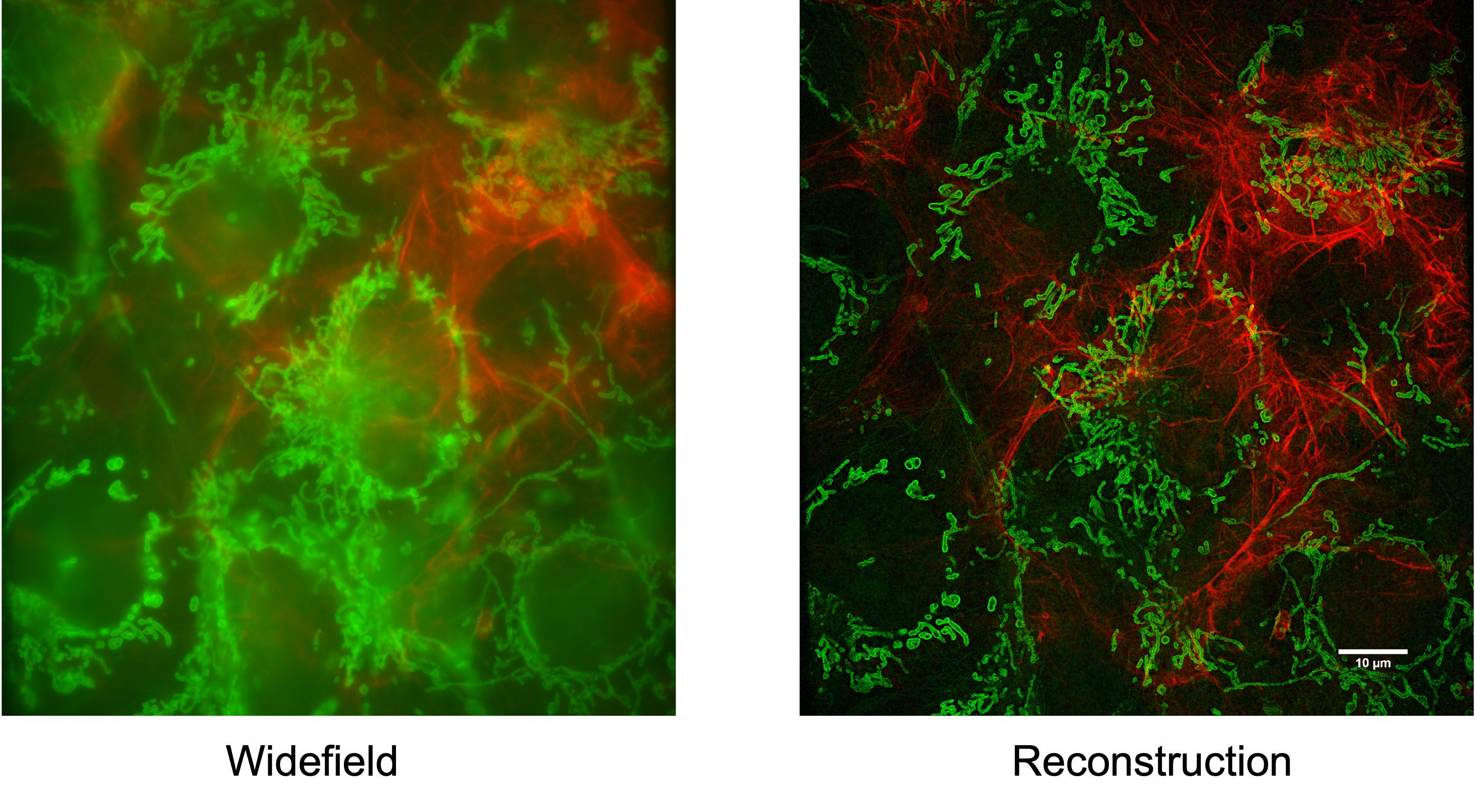 Multicolour Super-resolution Imaging